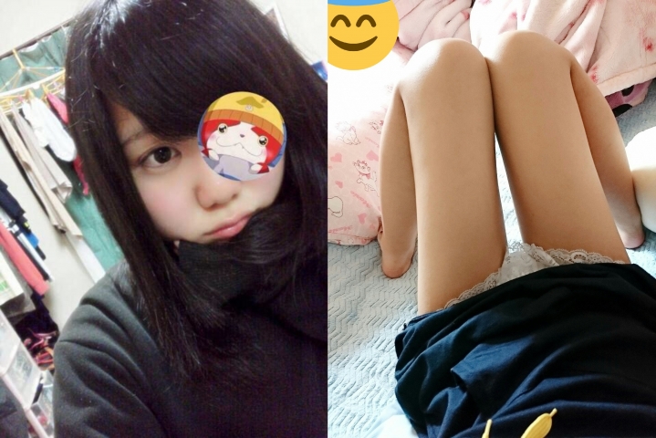 はえかけ レベル椎